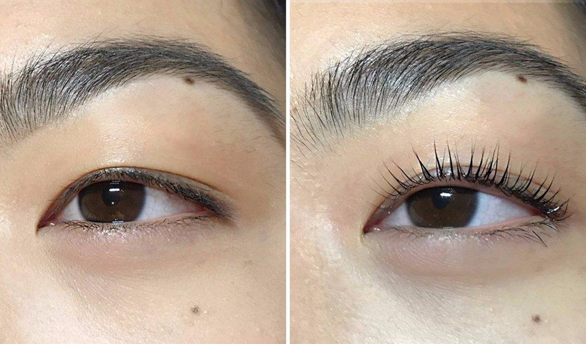 Eye Treatment Example 2