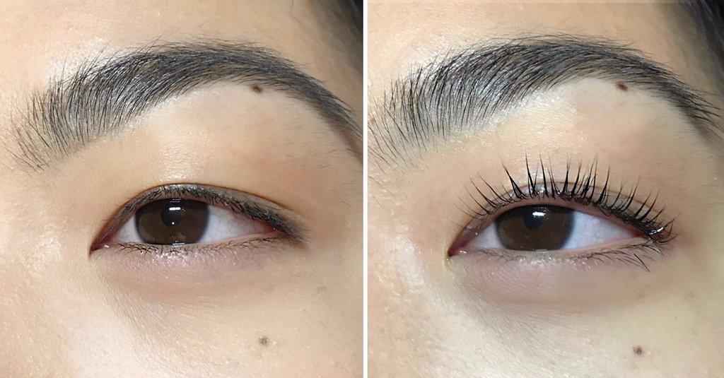 Eye Treatment Example 2